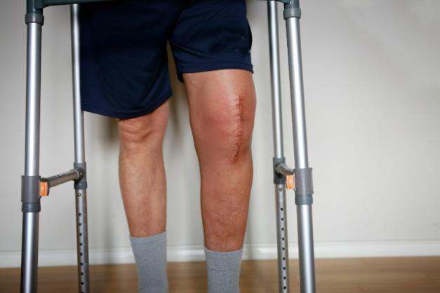 récupération rapide après chirurgie